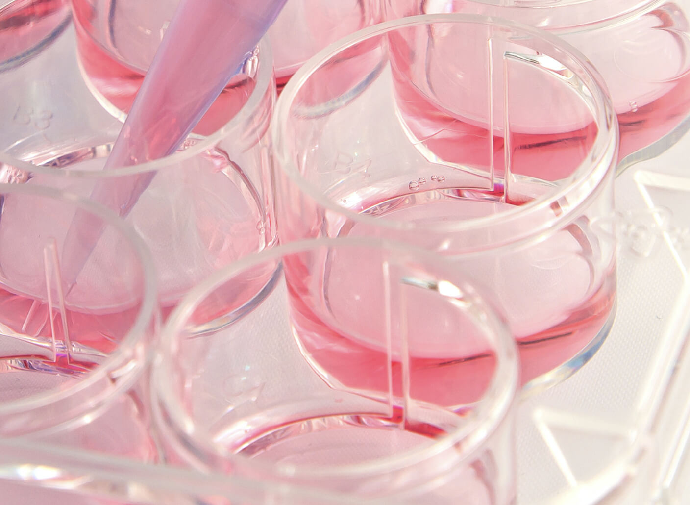 vitro